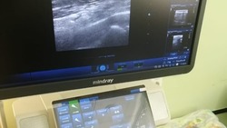 Белгородская областная детская клиническая больница получила новый высокотехнологичный аппарат УЗИ